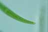 Closterium rostratum