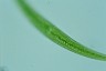 Closterium rostratum