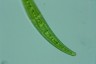 Closterium rostratum