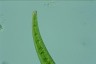 Closterium rostratum