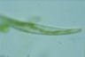 Closterium rostratum