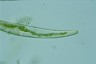 Closterium rostratum