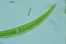 Closterium rostratum