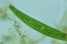 Closterium striolatum