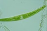 Closterium intermedium