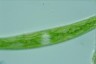 Closterium intermedium