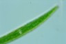 Closterium intermedium