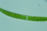 Closterium intermedium