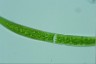 Closterium intermedium