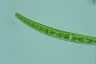 Closterium intermedium