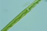 Closterium lineatum