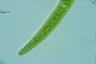 Closterium intermedium