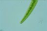 Closterium intermedium