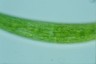 Closterium striolatum