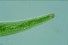 Closterium striolatum