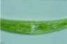 Closterium striolatum