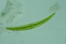 Closterium rostratum