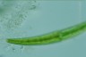 Closterium rostratum