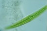 Closterium rostratum