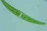 Closterium rostratum