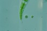 Closterium leibleinii