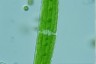 Closterium acerosum