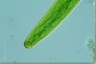 Closterium baillyanum