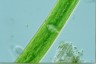 Closterium baillyanum