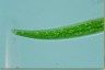 Closterium rostratum