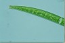 Closterium intermedium