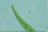 Closterium rostratum