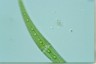 Closterium rostratum