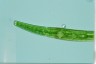 Closterium intermedium