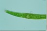 Closterium intermedium