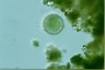 Acanthocystis