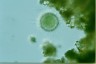 Acanthocystis