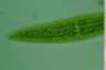 Closterium lunula