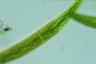 Closterium baillyanum