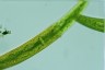 Closterium baillyanum