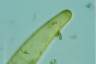 Closterium baillyanum