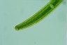 Closterium baillyanum