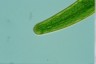 Closterium baillyanum