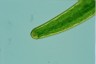 Closterium baillyanum