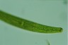 Closterium baillyanum