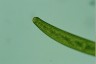 Closterium baillyanum