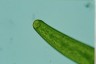 Closterium baillyanum