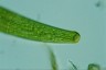 Closterium baillyanum