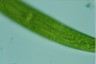 Closterium baillyanum