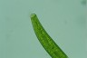 Closterium baillyanum