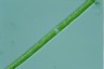 Closterium praelongum